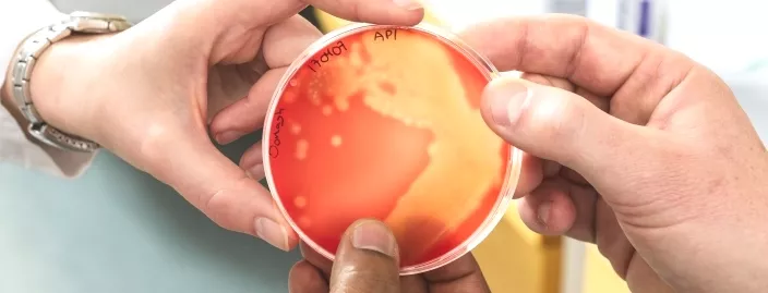 Two hands holding an agar plate with bacteria. Photo.